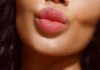 Пластика губ Булхорн та Хейлопластика: за і проти